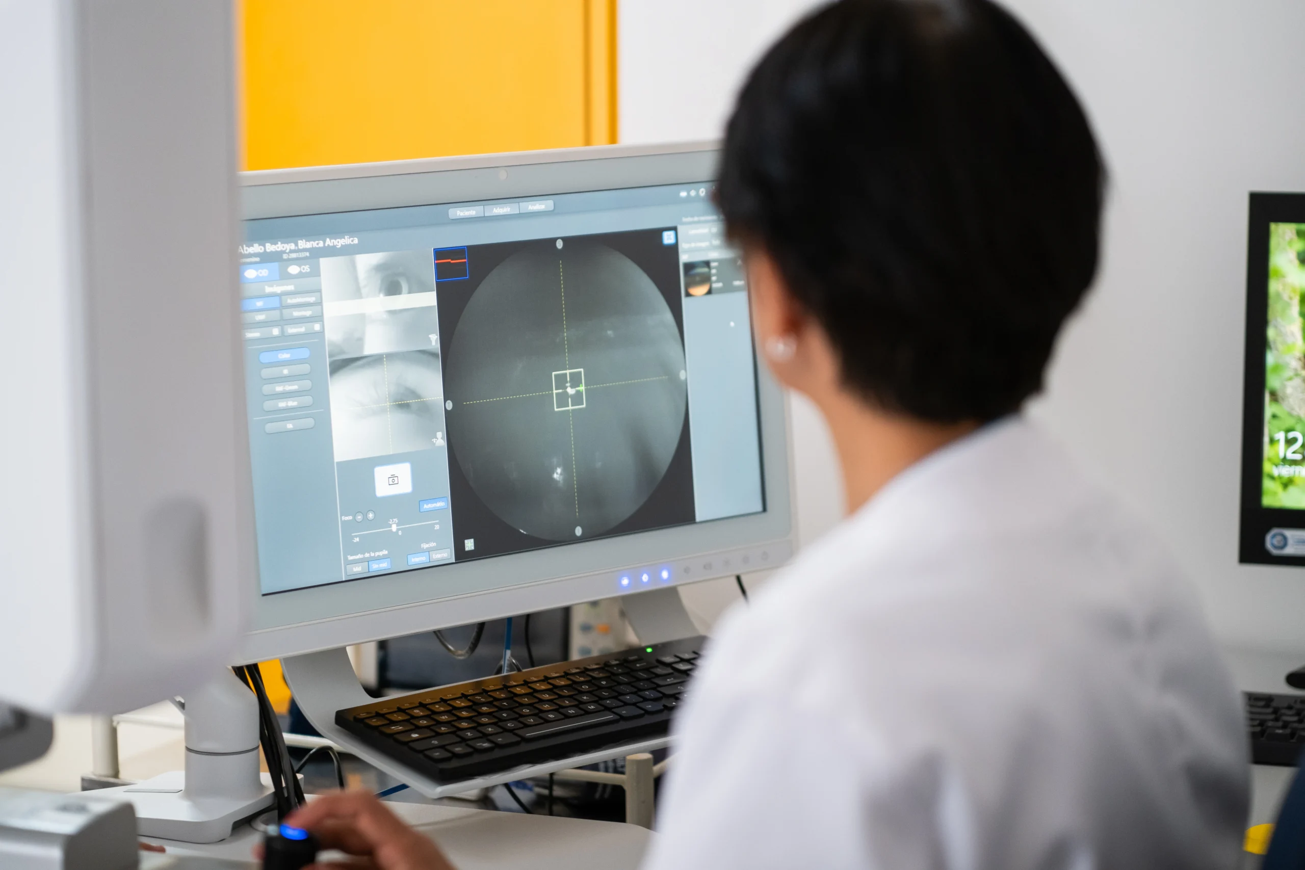 Profesional de la salud analizando una retinografía en pantalla en Clínica AVI