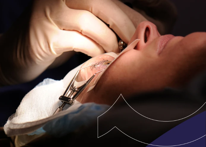 Cirujano realizando un transplante de córnea a un paciente en una clínica
